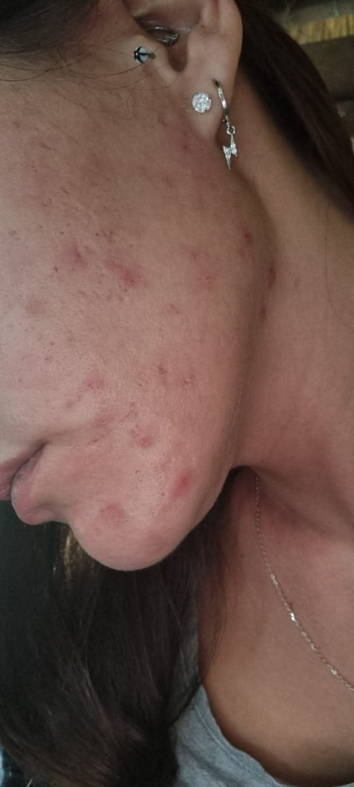 Community skincare result close-up