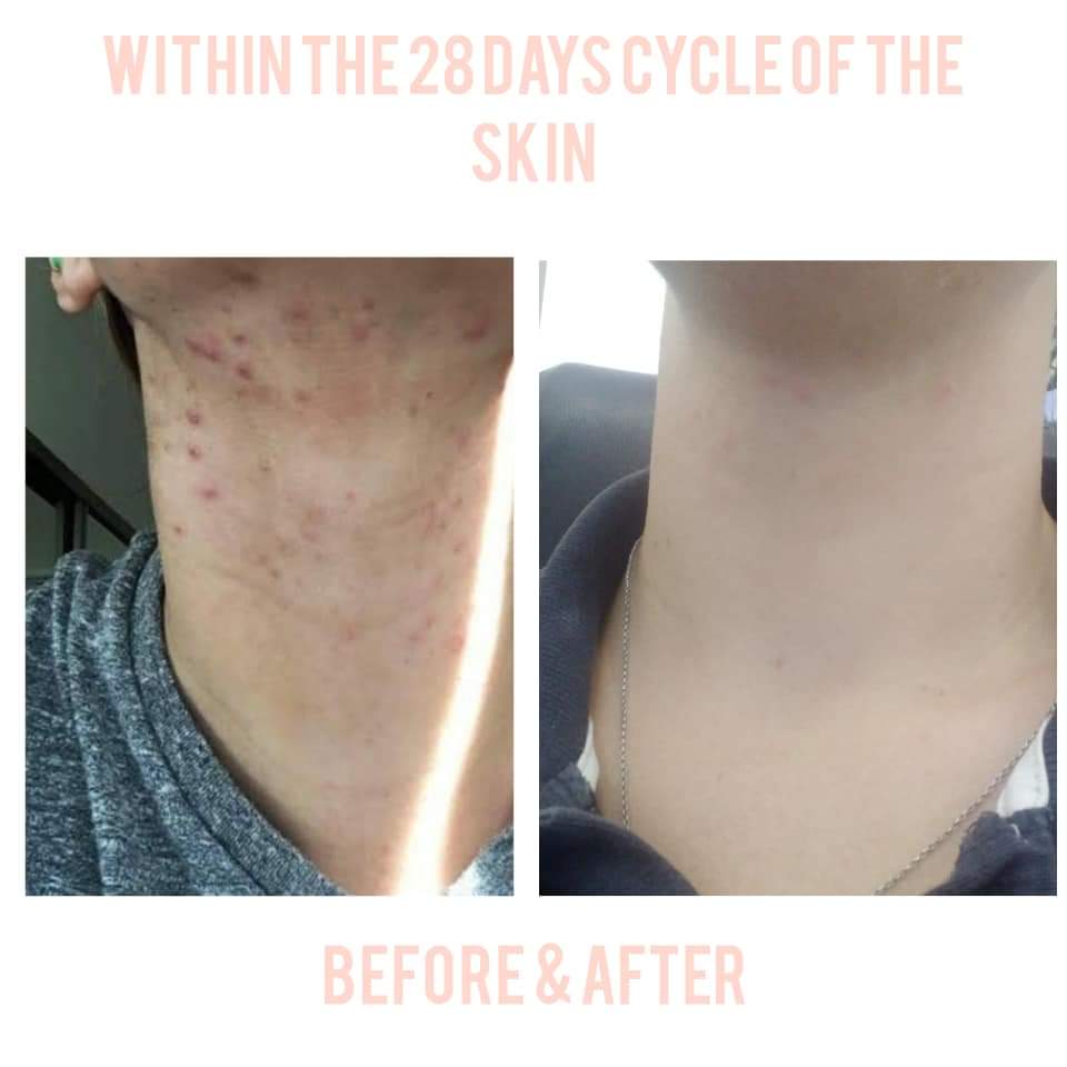 Community neck skincare before and after comparison